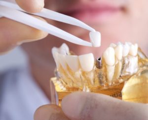chirurgia ed implantologia